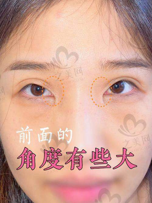 真实实例成效明显