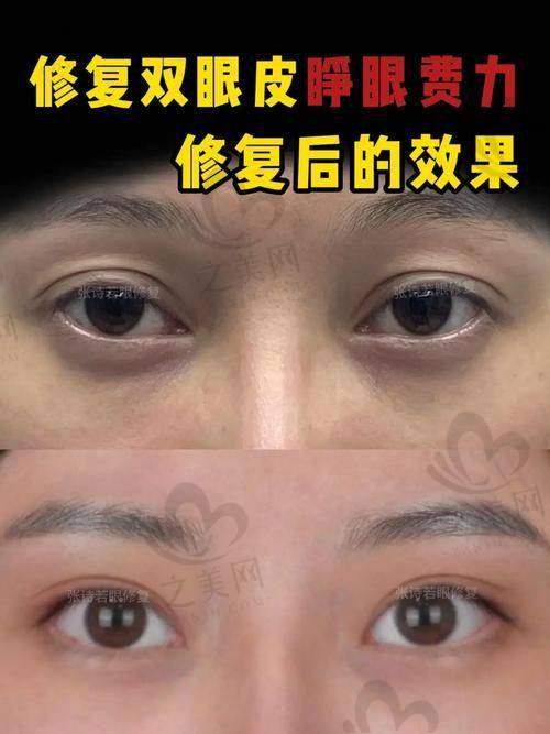 张诗若医生资历深厚