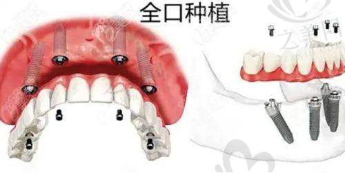 广东汕头天佑口腔中 心实例