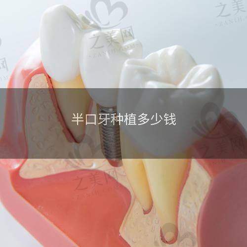 深圳自有光口腔体验舒适