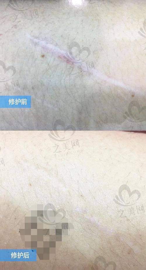 医生团队：经验多，专精不错服务优