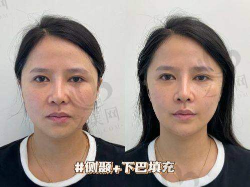 广东美恩整形美容医院技术领跑