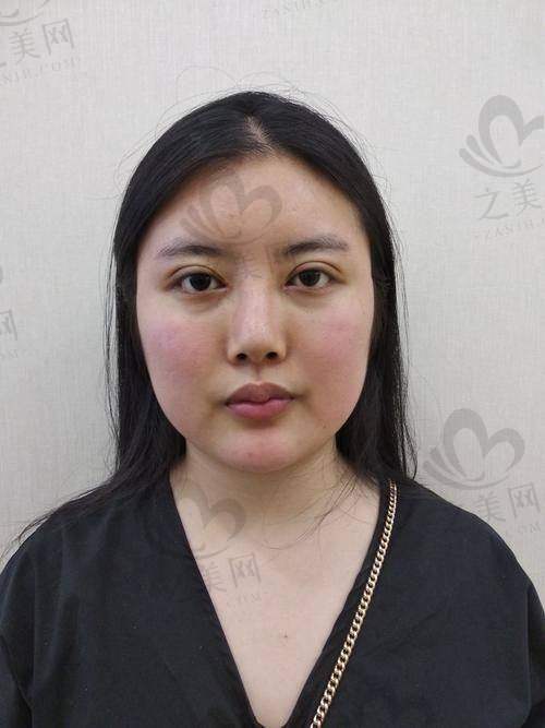 广东韩妃医疗美容医院表现出色