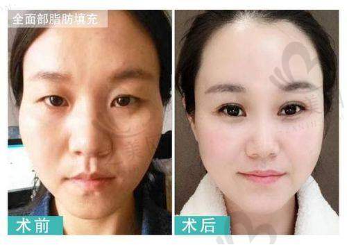 广州紫馨医疗美容医院理念精良
