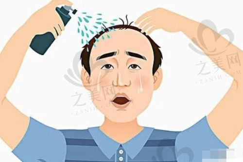 其他值得关注的植发机构