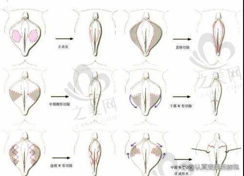 八大处私密整形涵盖多领域