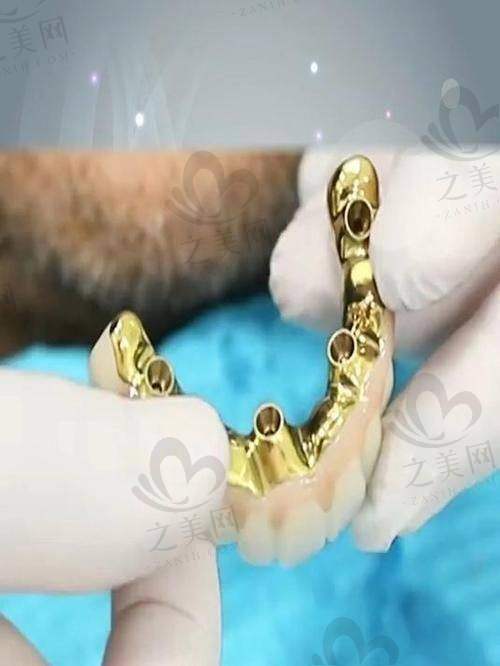 六盘水水城口腔医院矫正佳