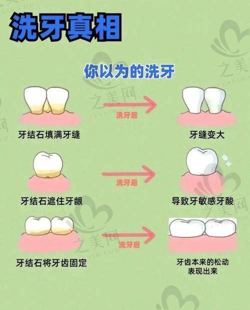 杭美美呀种植专科地址在哪,价格咋样?分院交通便利,种植牙3000元起,多项目价优!