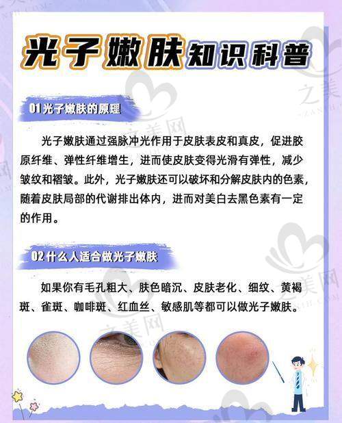 治疗过程较舒适