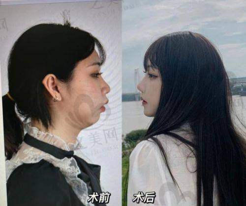 曹卫刚医生:全科整形的抗衰能手