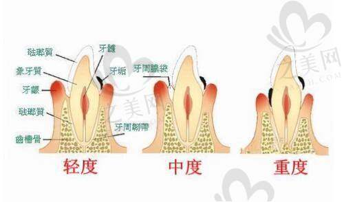 四川大学华 西医院男科中 心:精尖综合实力
