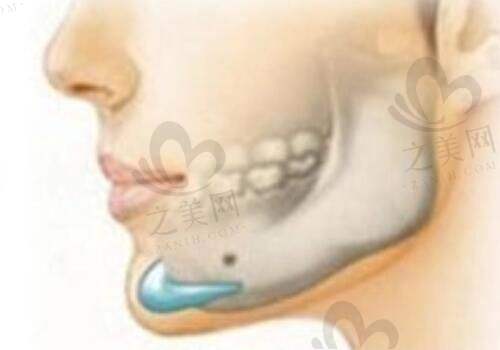 苏州大学附属第二医院整形美容外科——胸部整形老牌专科