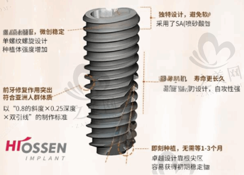 杭州口腔医院种植牙情况参考