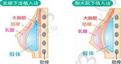 黄江泊医生:注重细节的拉皮高手