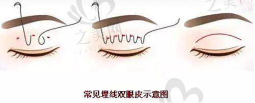 医生团队强大，技术不错
