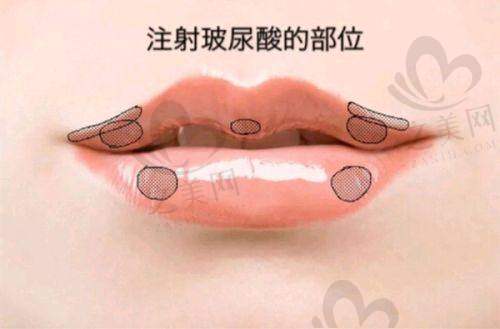 北京加减美医疗美容门诊部:正规医美,面部提升技术优、口碑好,多方式可便捷预约!