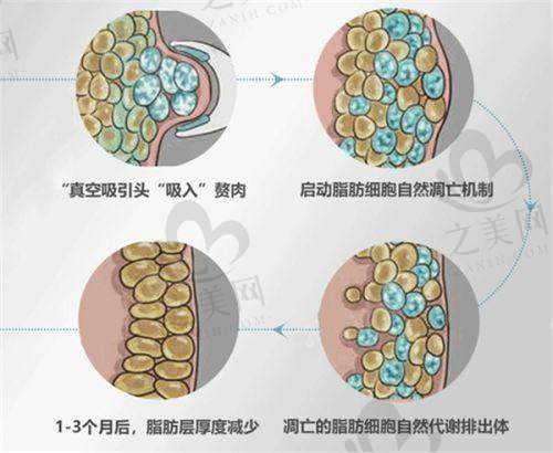 私密整形有特色