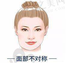 想整形不用愁!武汉艺星医疗美容靠谱受认可,汉口武昌店各有特色服务优