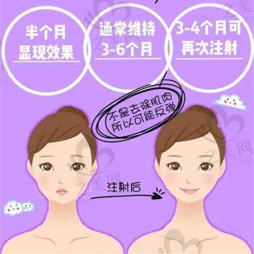 深圳鹏程整形医院是正规私立医美机构,隆鼻隆胸祛疤等项目出色,收费合理口碑好