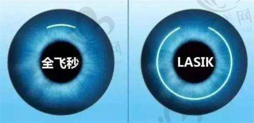 选择宜春爱尔眼科医院的优势总结