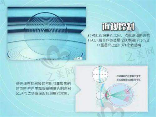 襄阳爱尔眼科医院:特色科室与价格参考