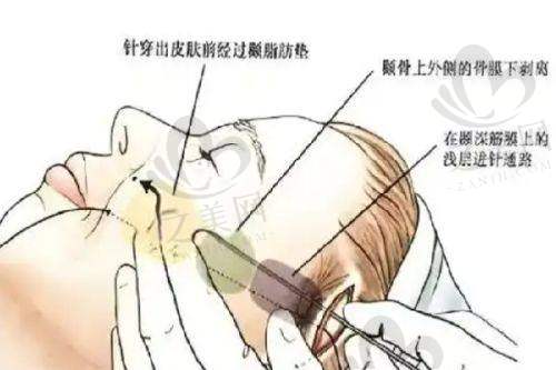 黄寅守：韩国经验的整形医生
