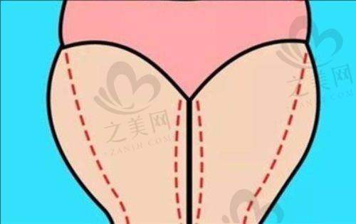 综合排名前列的隆胸医院优势明显