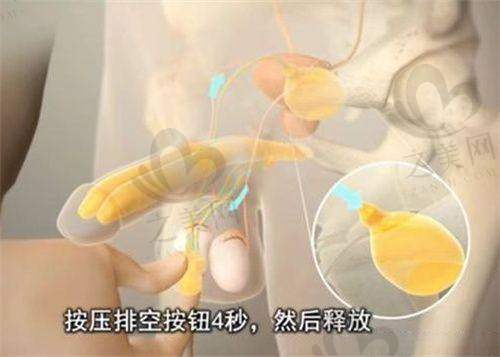 南京健丽医美:专注眼部年轻化的刘振龙医生