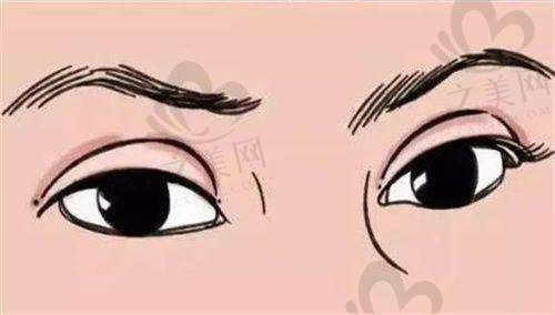王共礼医生:眼整形经验多