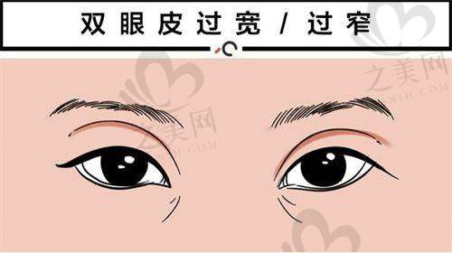 隆胸手术优势突出的医院