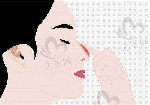 醫(yī)院有名骨干醫(yī)生醫(yī)生經驗多