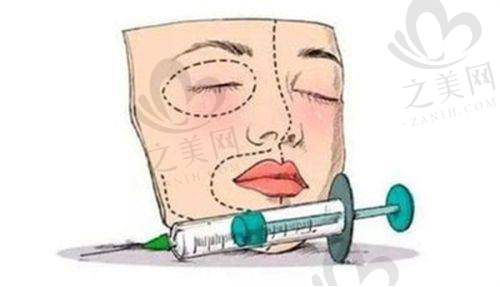 如何选择合适的胸部整形医院