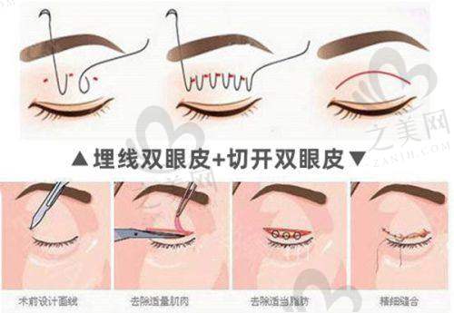 新疆医 科 大学第二附属医院:专精能力值得考虑