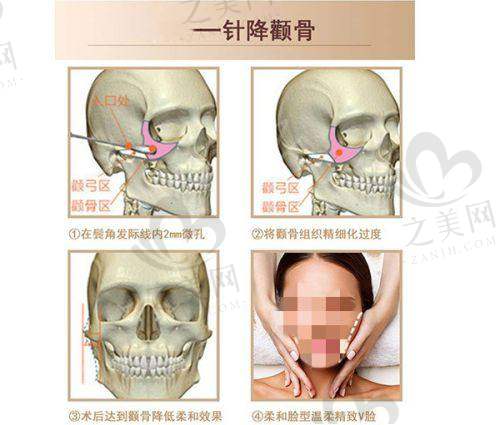 成都增长增粗排名靠前的医院