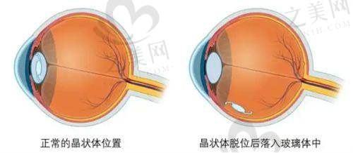 福州省立医院整形科郑胜武医生
