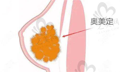 深圳面部SM筋膜提升排名靠前医院——各有特色