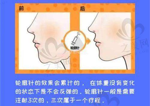 新疆威茲曼整形外科醫(yī)院：技術(shù)精良滿意度高