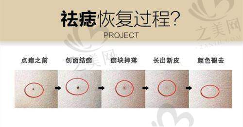 选择医院注意事项多
