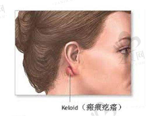 眼部整形手术价格参考