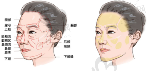 选择医院的建议