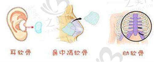 梁青松医生:追求自然美风格