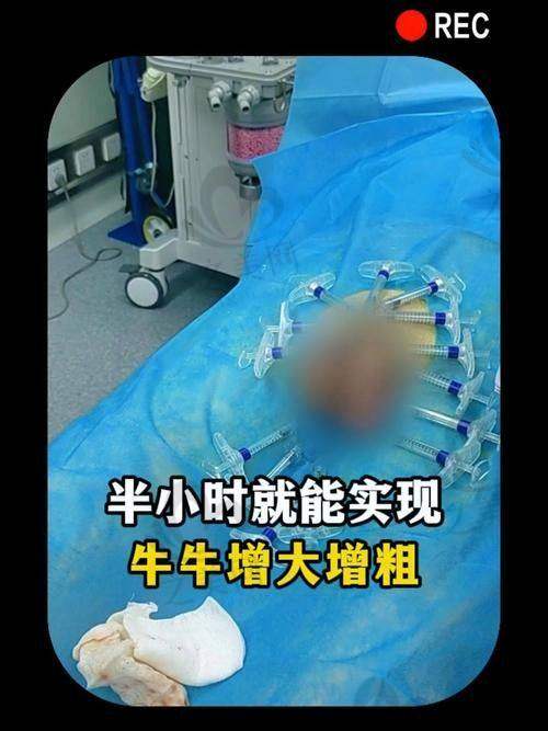 部分男科医疗项目价格：参考范围明晰