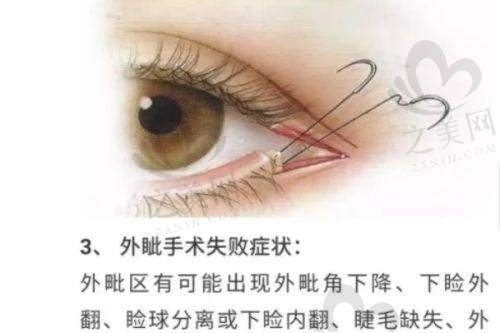 潍坊医学校附属医院皮肤科挂号攻略