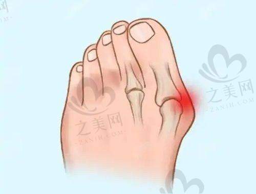 皮肤病理检查:确定疾病类型和程度