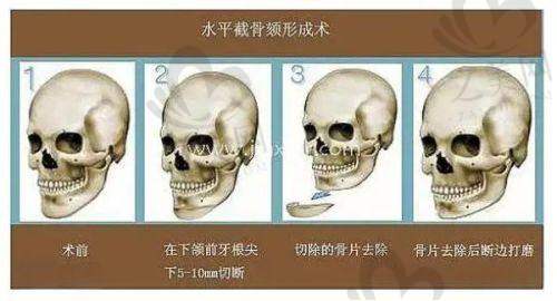 长春市中医院平阳部张春洪医生中西结合