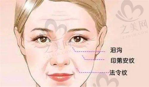 患者选择建议