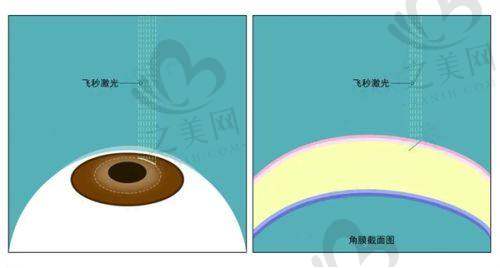 手术价格清晰合理