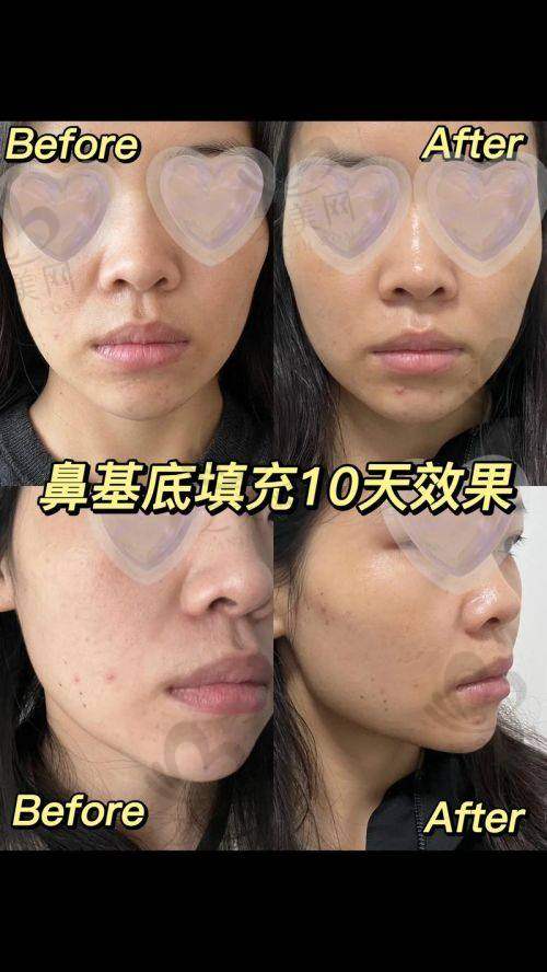 价格优势：透明合理有保护