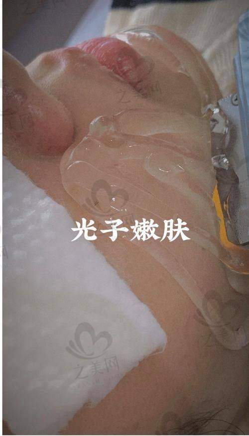 重庆美仑美奂医院价格亲民的原因
