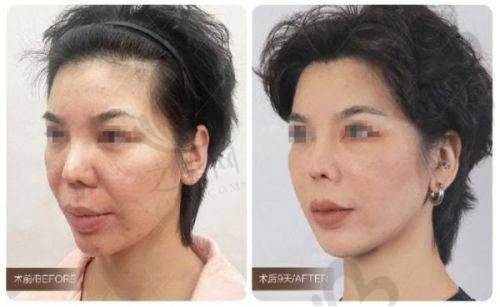 北京童仁医疗美容门诊部口碑评价